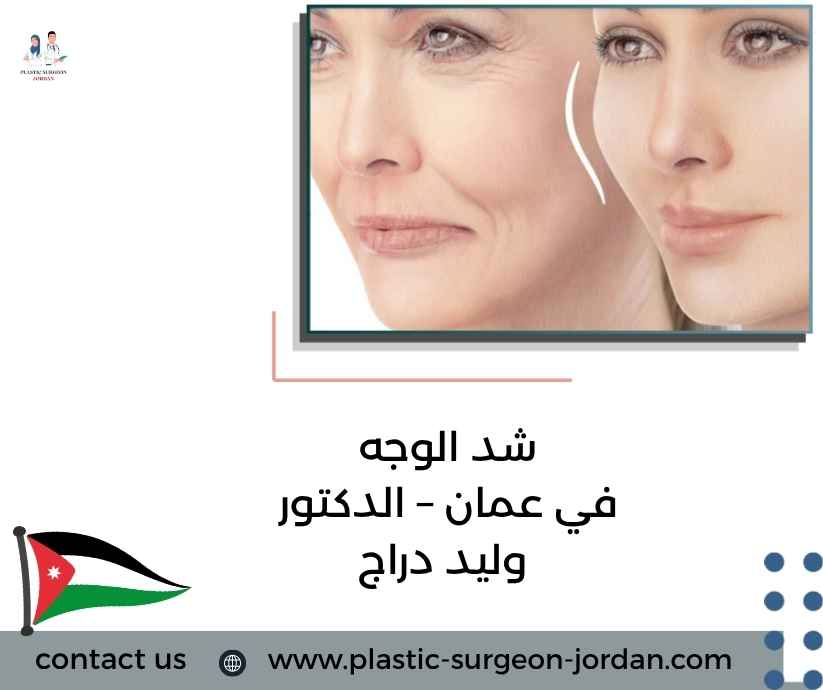 شد الوجه في عمان – الدكتور وليد دراج شد الوجه في عمان – الدكتور وليد دراج