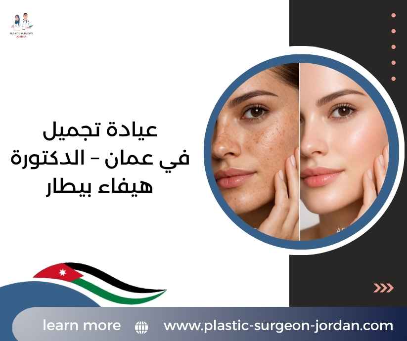 عيادة تجميل في عمان – الدكتورة هيفاء بيطار عيادة تجميل في عمان – الدكتورة هيفاء بيطار