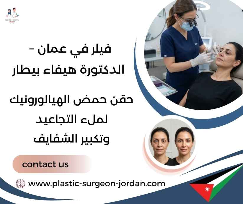 فيلر في عمان – الدكتورة هيفاء بيطار