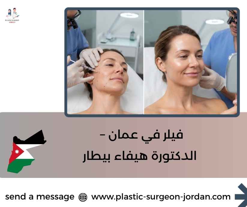 فيلر في عمان – الدكتورة هيفاء بيطار فيلر في عمان – الدكتورة هيفاء بيطار