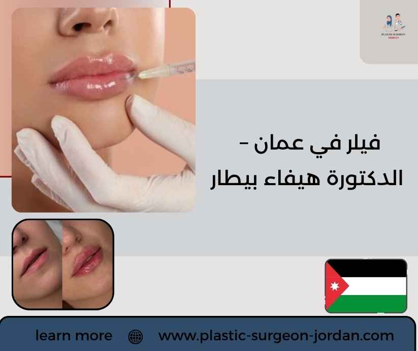 فيلر في عمان – الدكتورة هيفاء بيطار فيلر في عمان – الدكتورة هيفاء بيطار