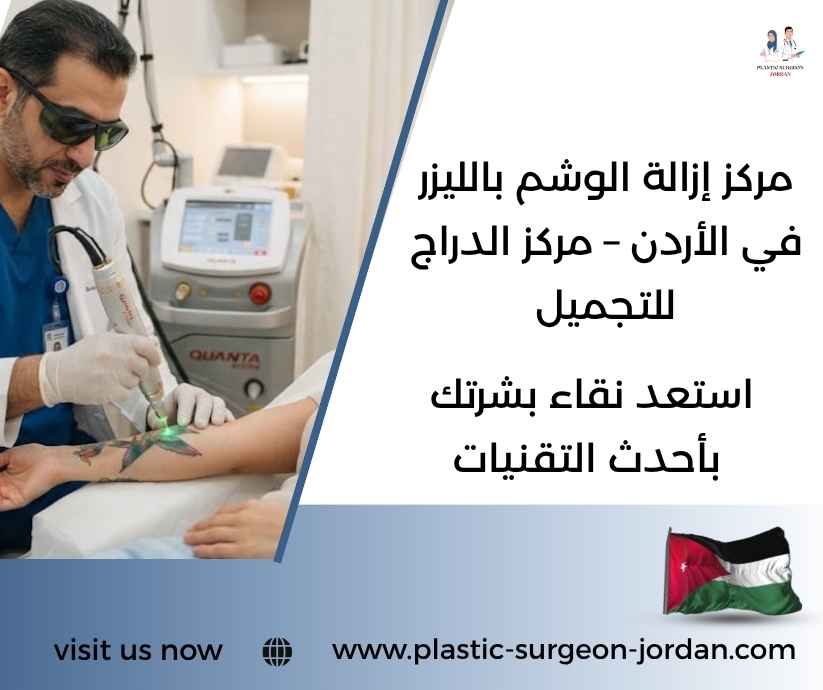 مركز إزالة الوشم بالليزر في الأردن