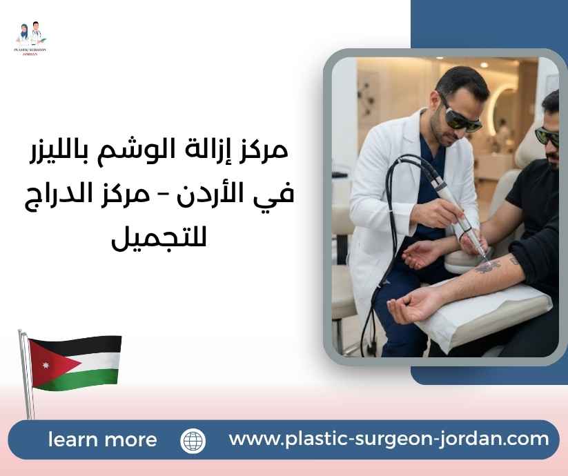 مركز إزالة الوشم بالليزر في الأردن