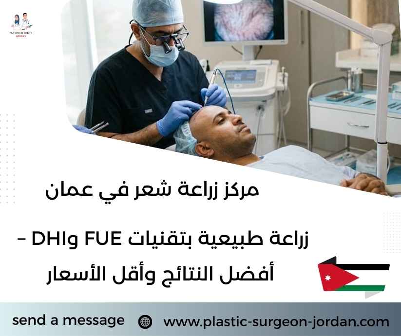 مركز زراعة شعر في عمان