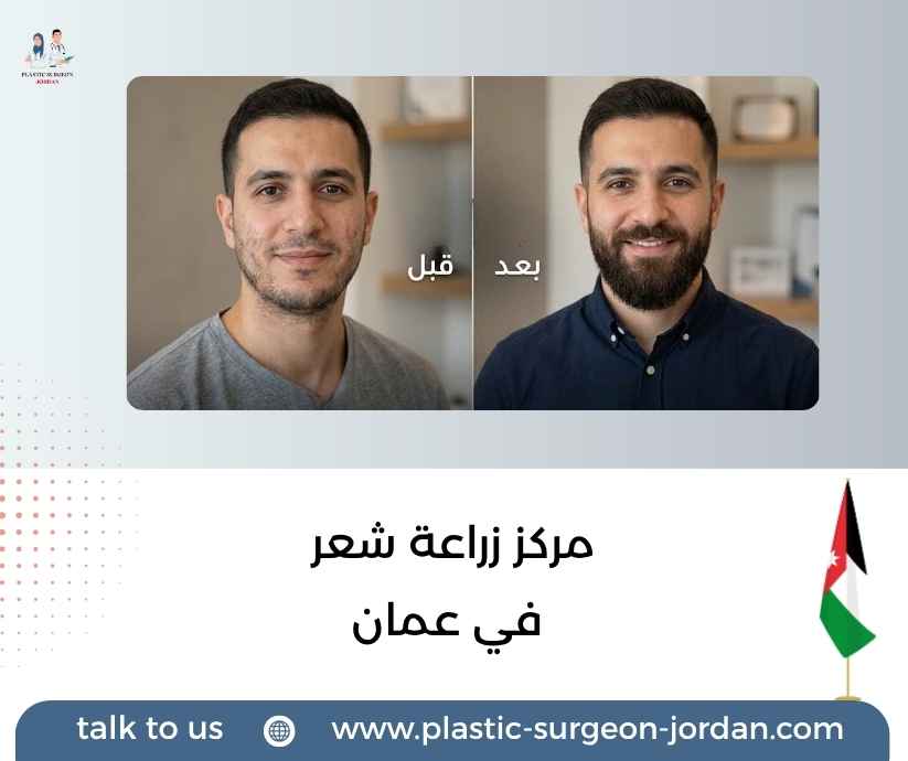 مركز زراعة شعر في عمان