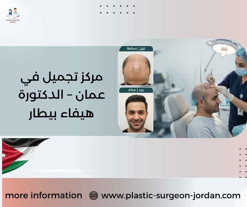 مركز تجميل في عمان – الدكتورة هيفاء بيطار